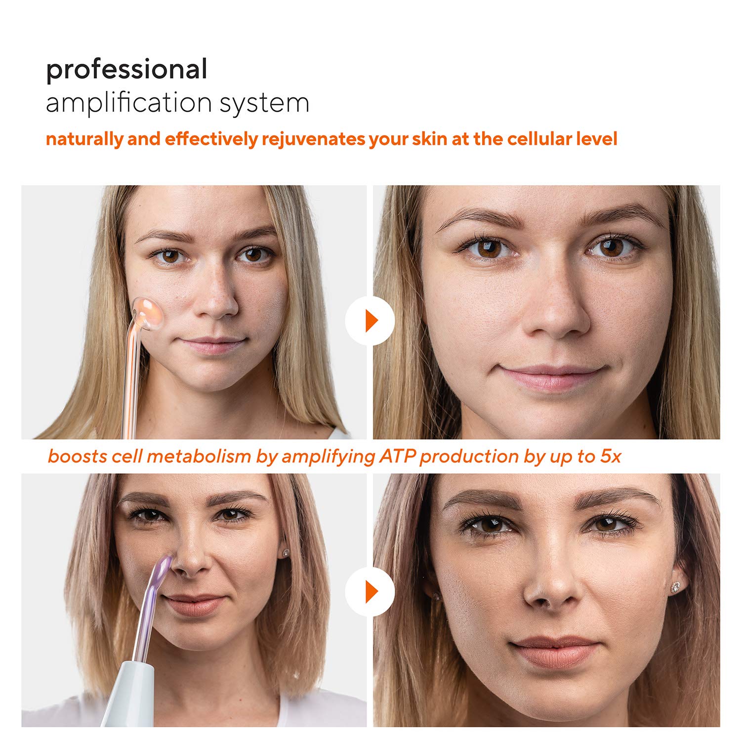 NuDerma Professional Skin Therapy Wand - Portable High Frequency Skin Therapy Machine (7545776668910)